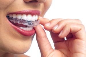 img orthodontics ad 06 https://sasebo.tv/category/orthodontics/orthodontic-adult/