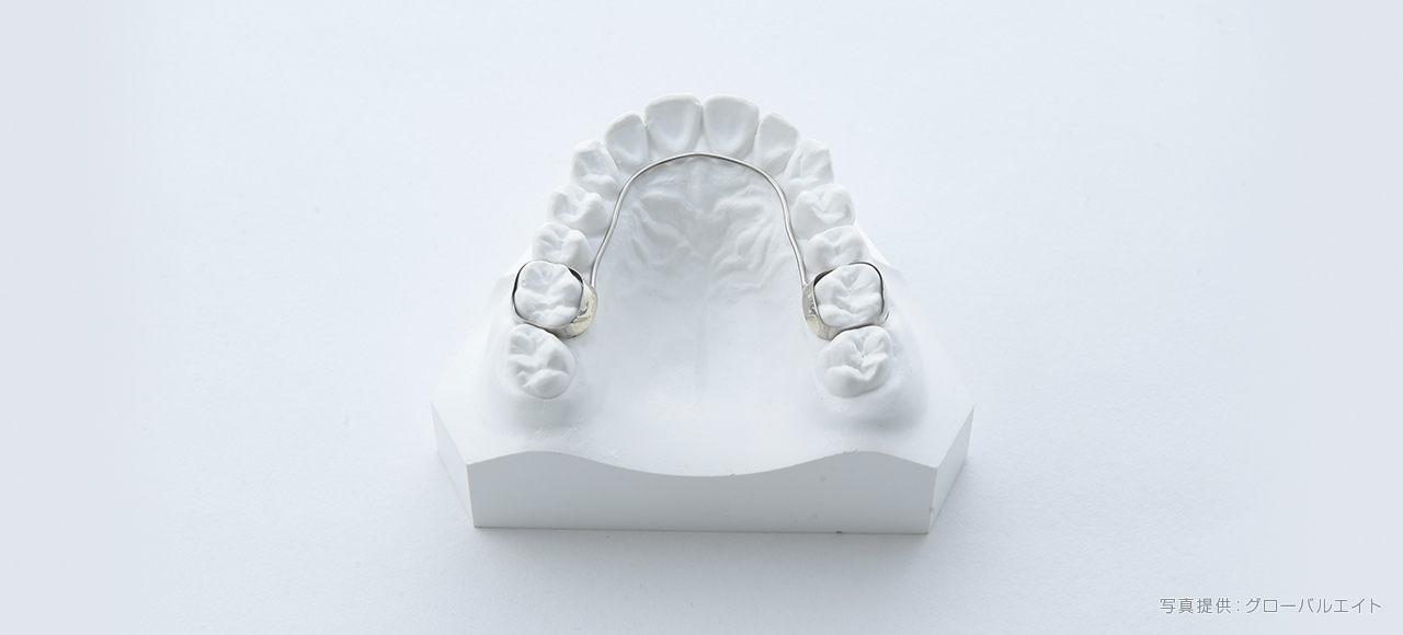 リンガルアーチ